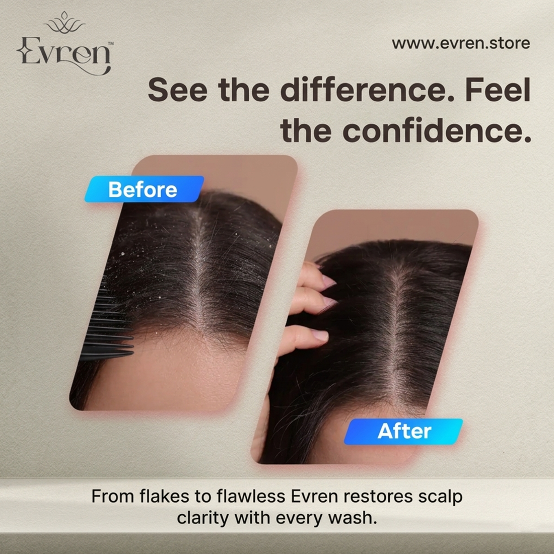 Évren Scalp Clarifying System (for antidandruff complete combo)