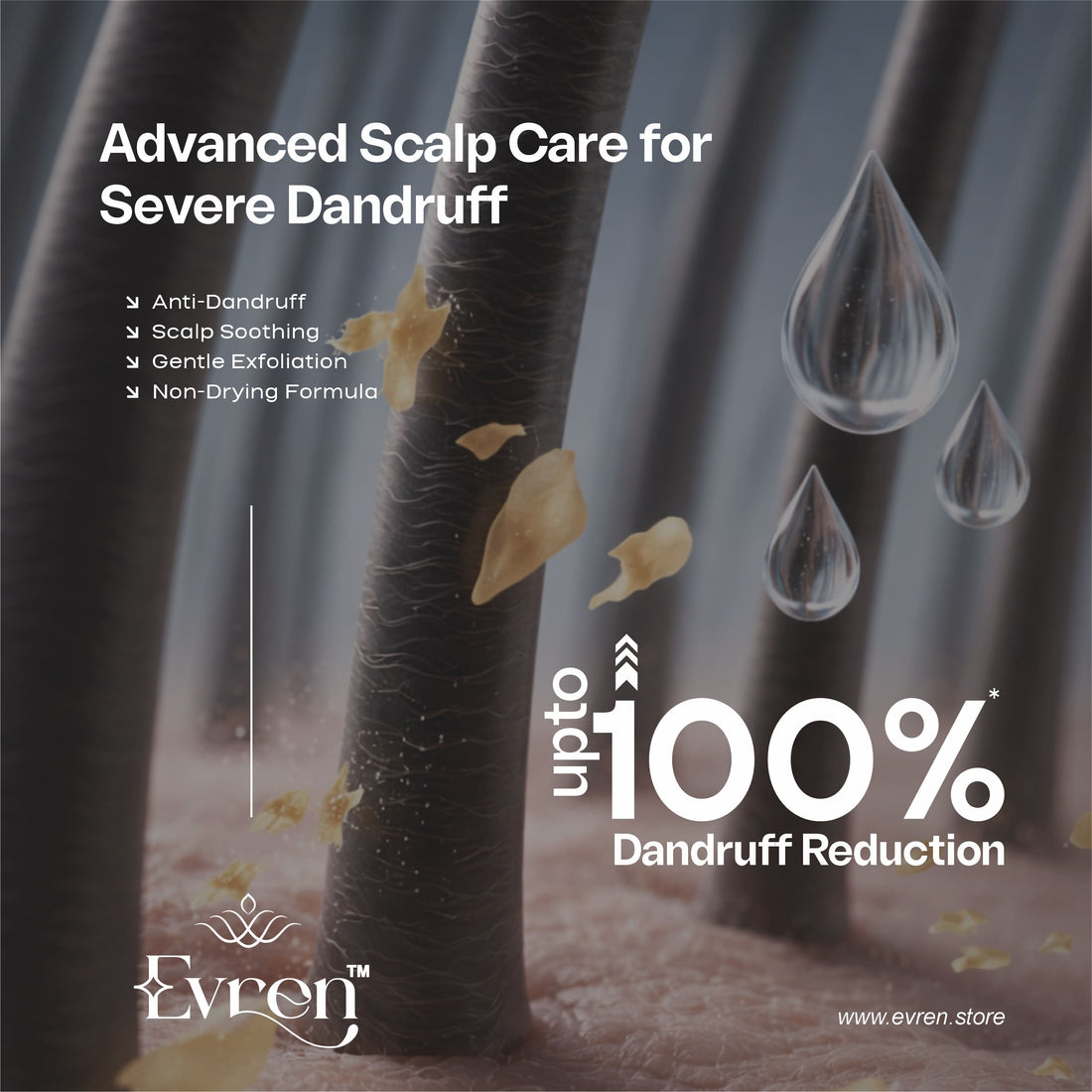 Ultimate Anti Dandruff Kit