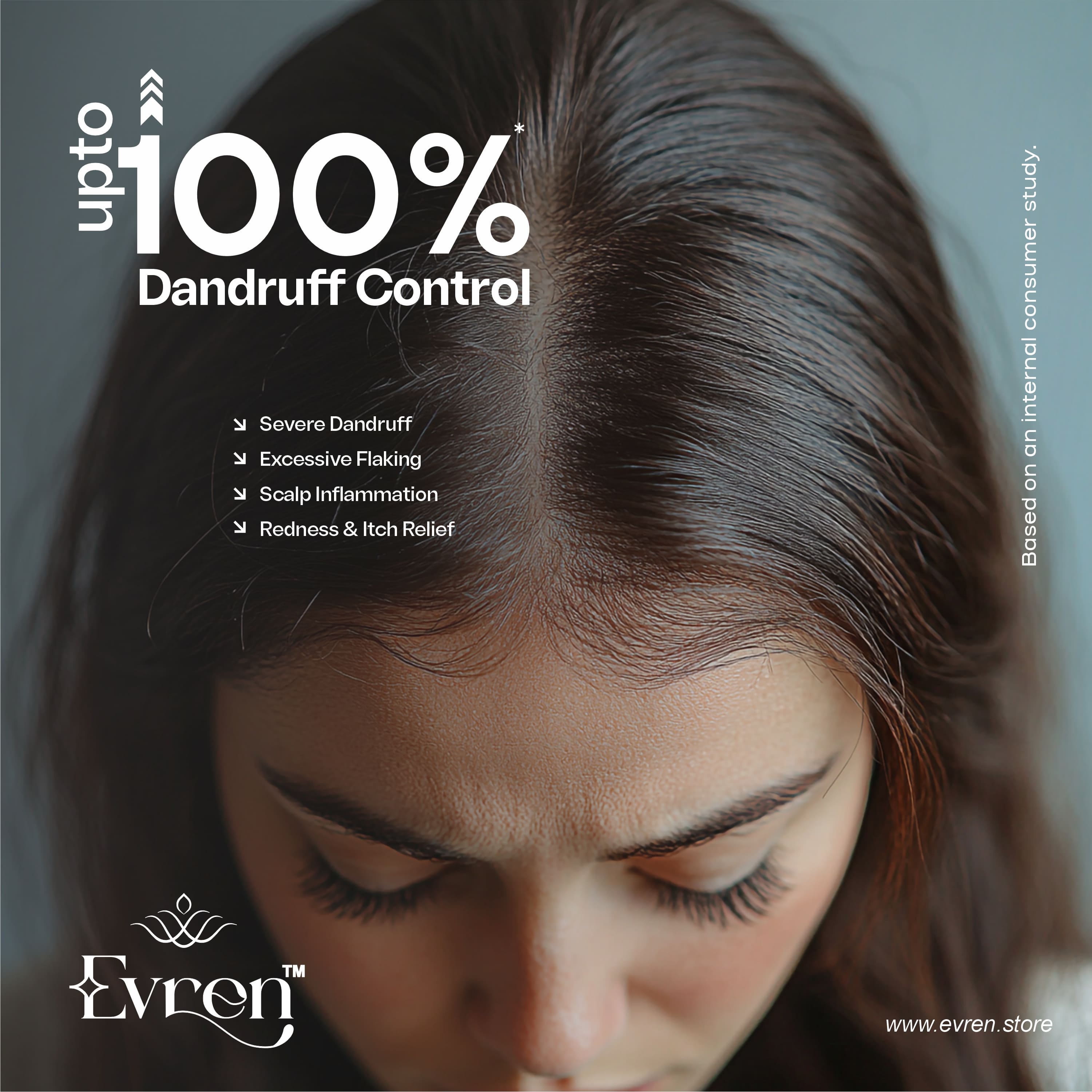 Ultimate Anti Dandruff Kit