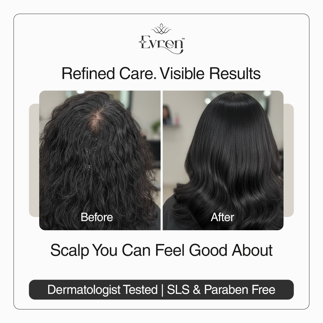 Anti-Dandruff Hair Oil