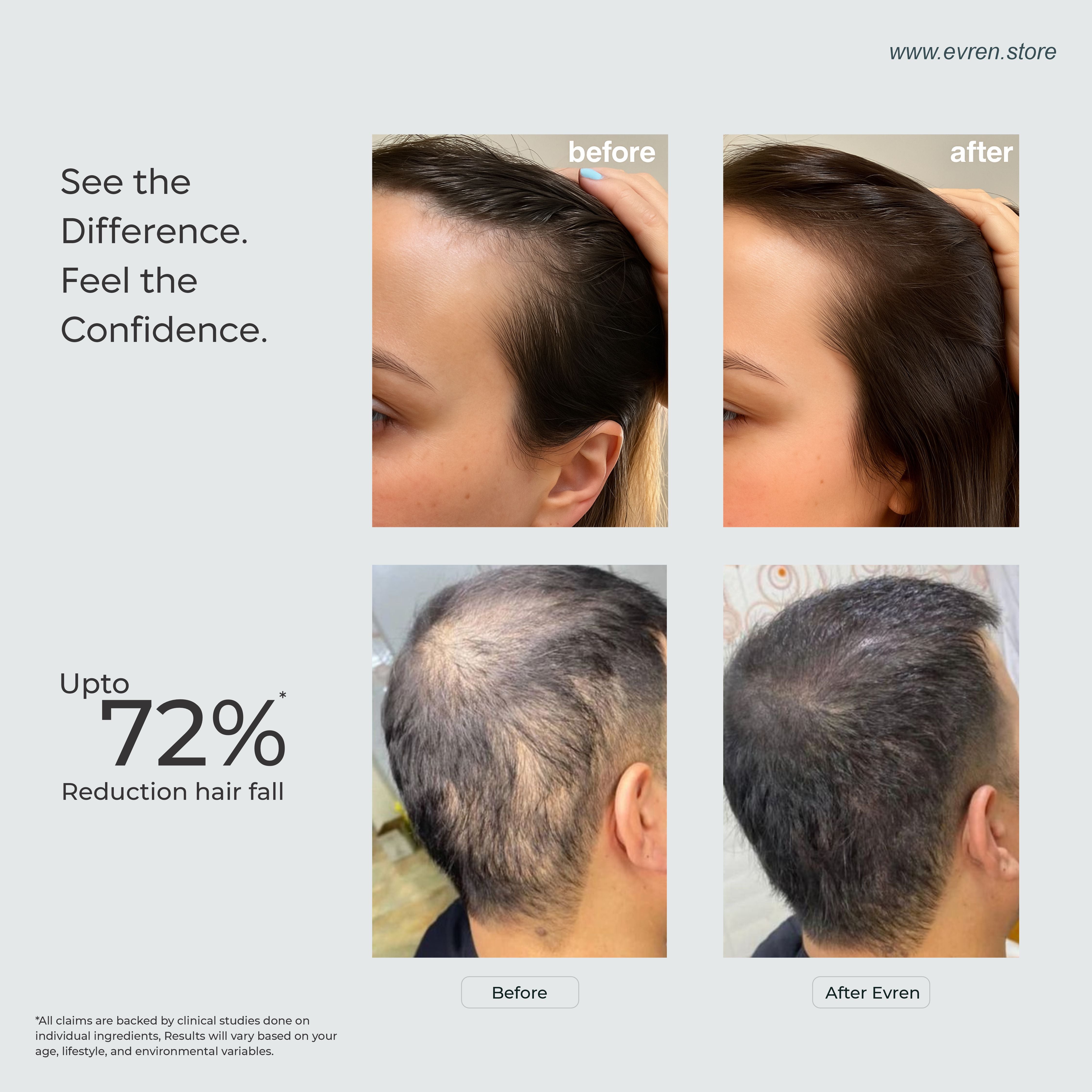 Hairfall Control Combo