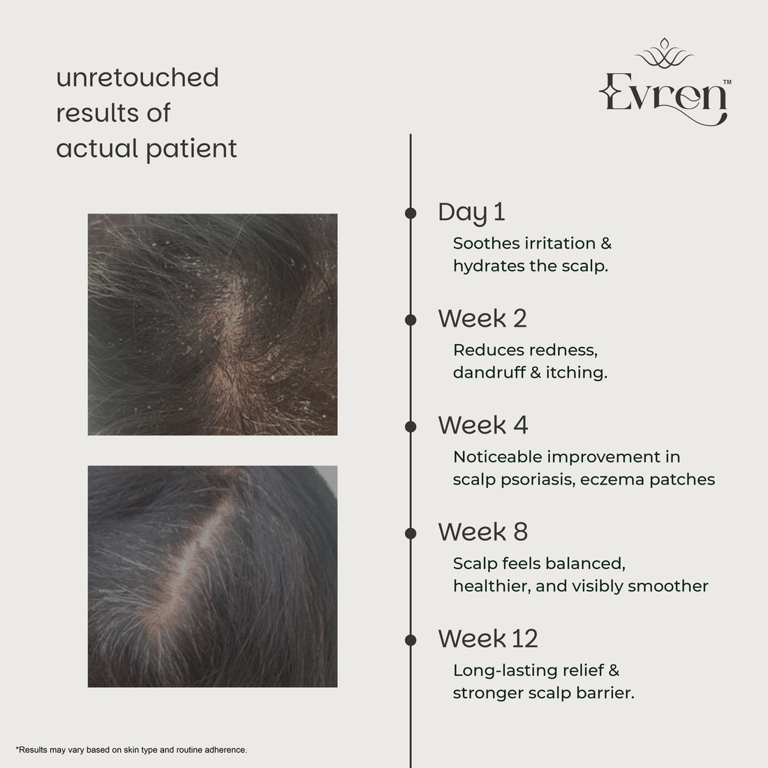 Dual Action Conditioner | Smoothens, Strengthens & Reduces Breakage