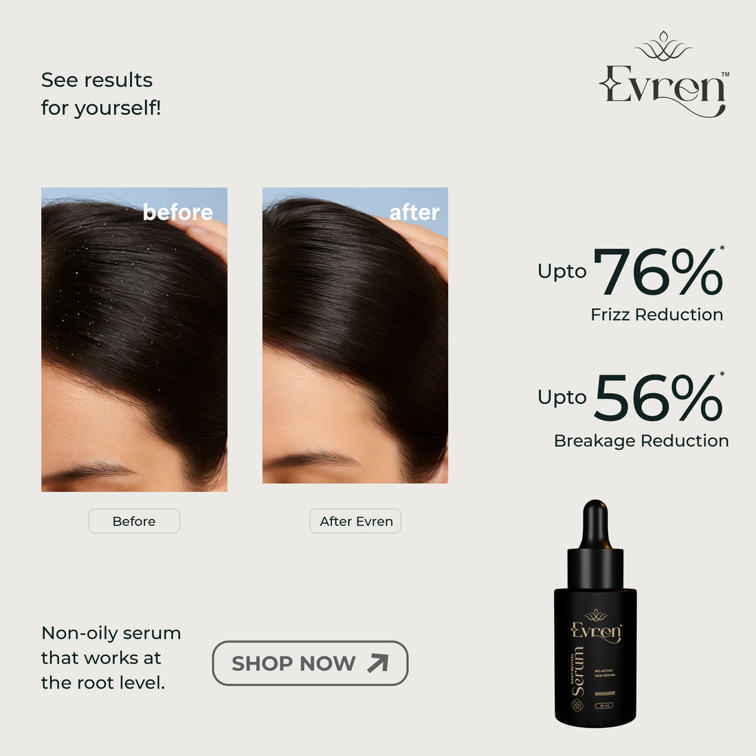 Anti-Hairfall Serum | Stimulates Growth & Strengthens Hair