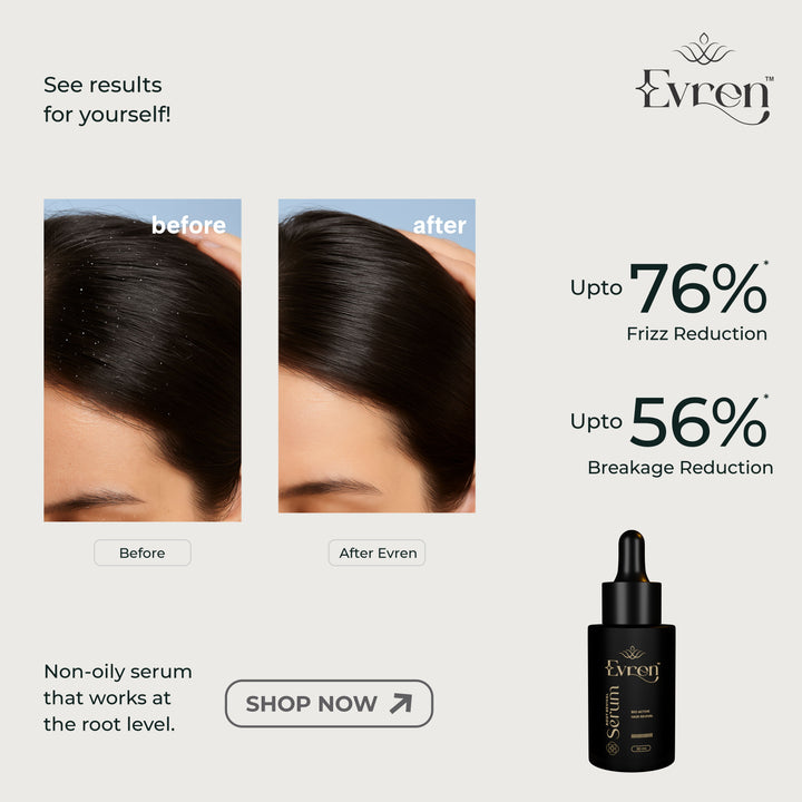 Anti-Hairfall Serum | Stimulates Growth & Strengthens Hair
