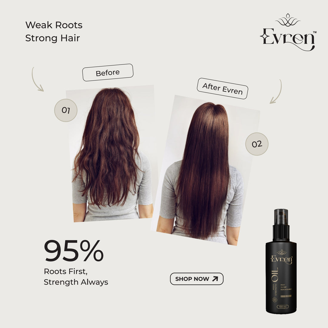 Anti-Hairfall Root Oil | Nourishes Follicles & Promotes Visible Growth