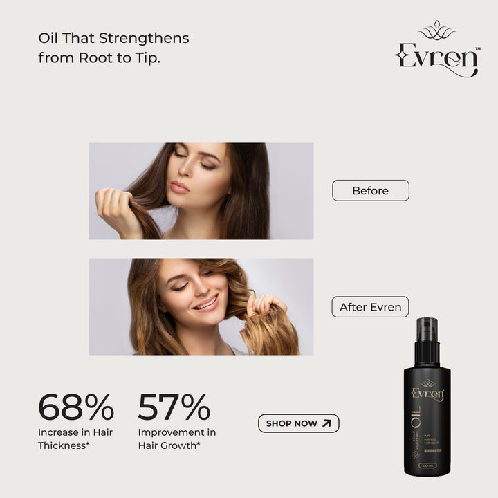 Anti-Dandruff Hair Oil | Clears Dandruff, Soothes Itchy Scalp & Strengthens Roots